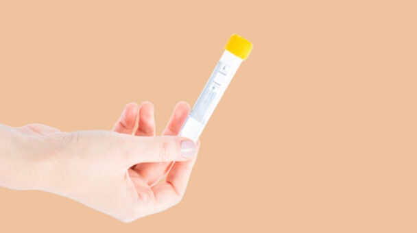 HPV Screening Image